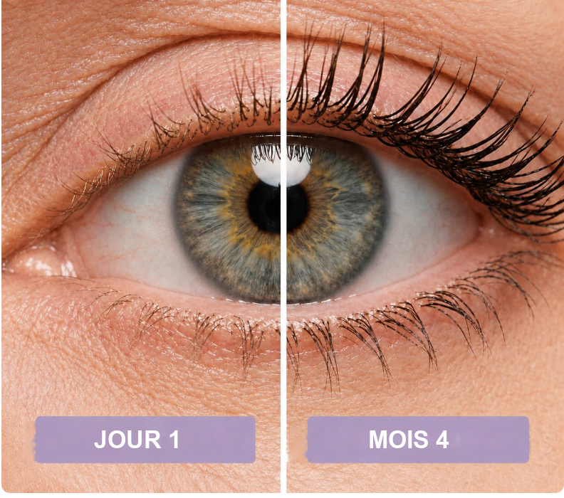 Cils au jour 1 et au mois 4